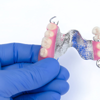 Filling The Gap: Dental Partials in Houston